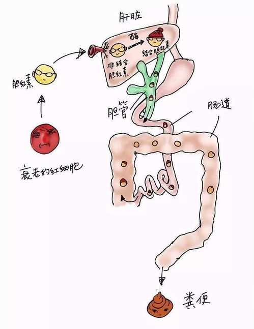 脸色蜡黄是肝脏不好还是脾胃不好呢