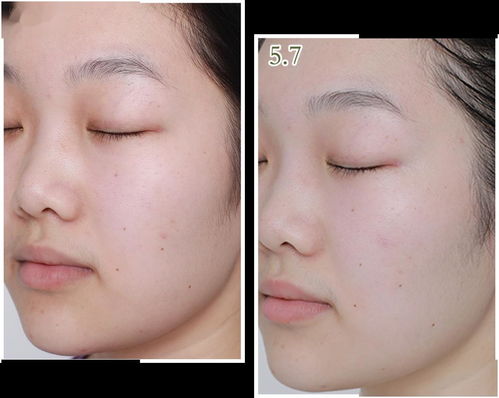 三天快速美白脸部方法,什么药膏能美白